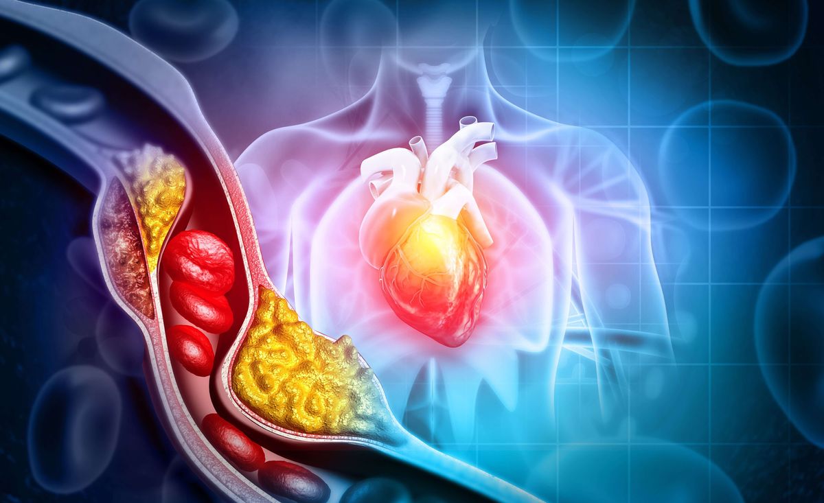 Is High Cholesterol Bad for your Health?